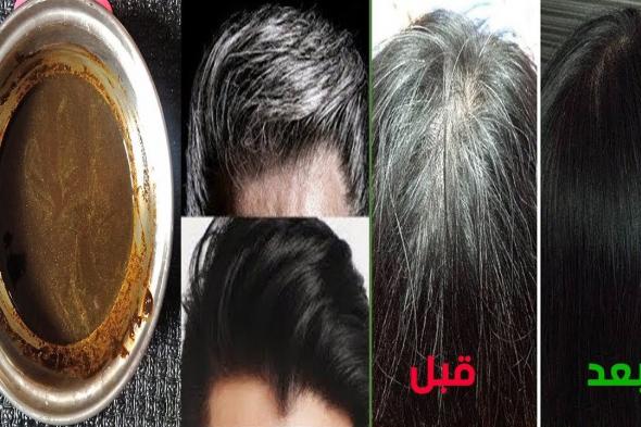 القرنفل وماء البصل للتخلص نهائيا من شيب الشعر الوصفة التي حيرت الاطباء في علاج الشيب